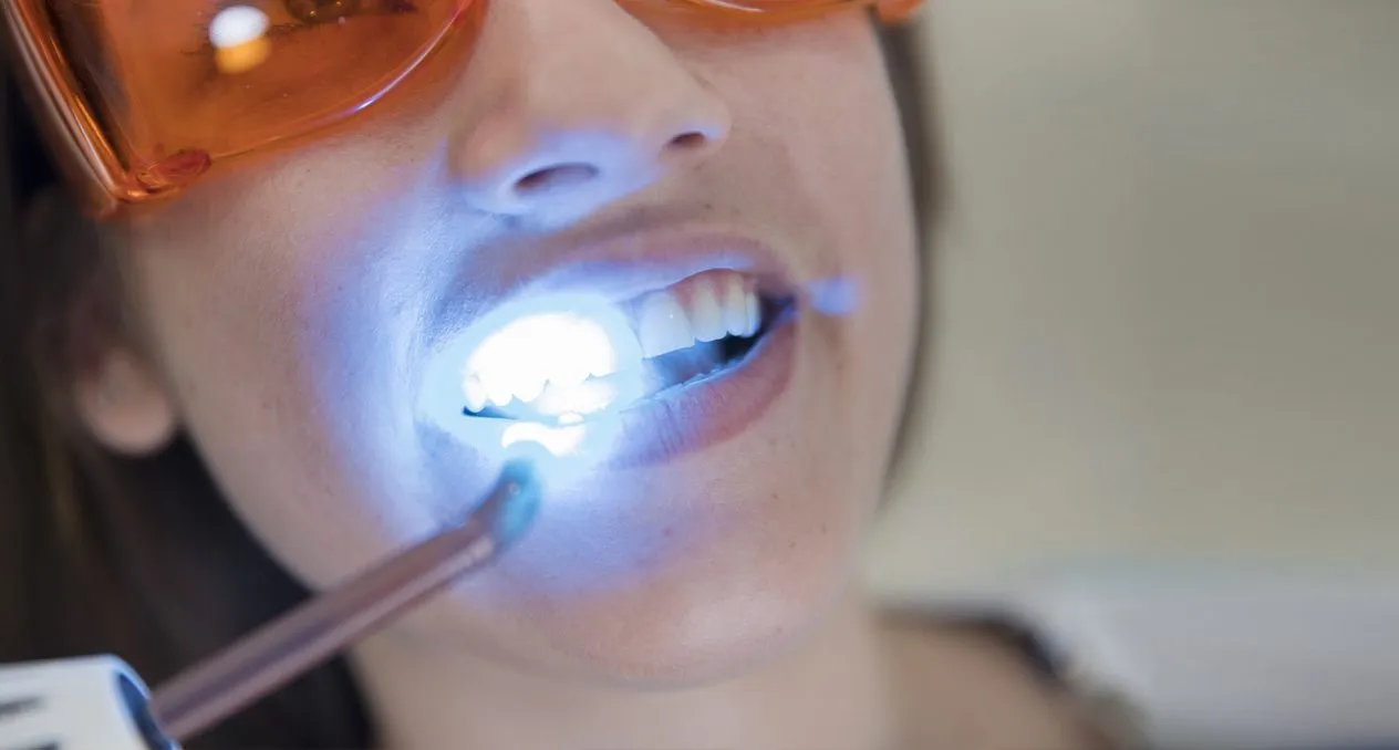 26491 teeth whitening wien image5