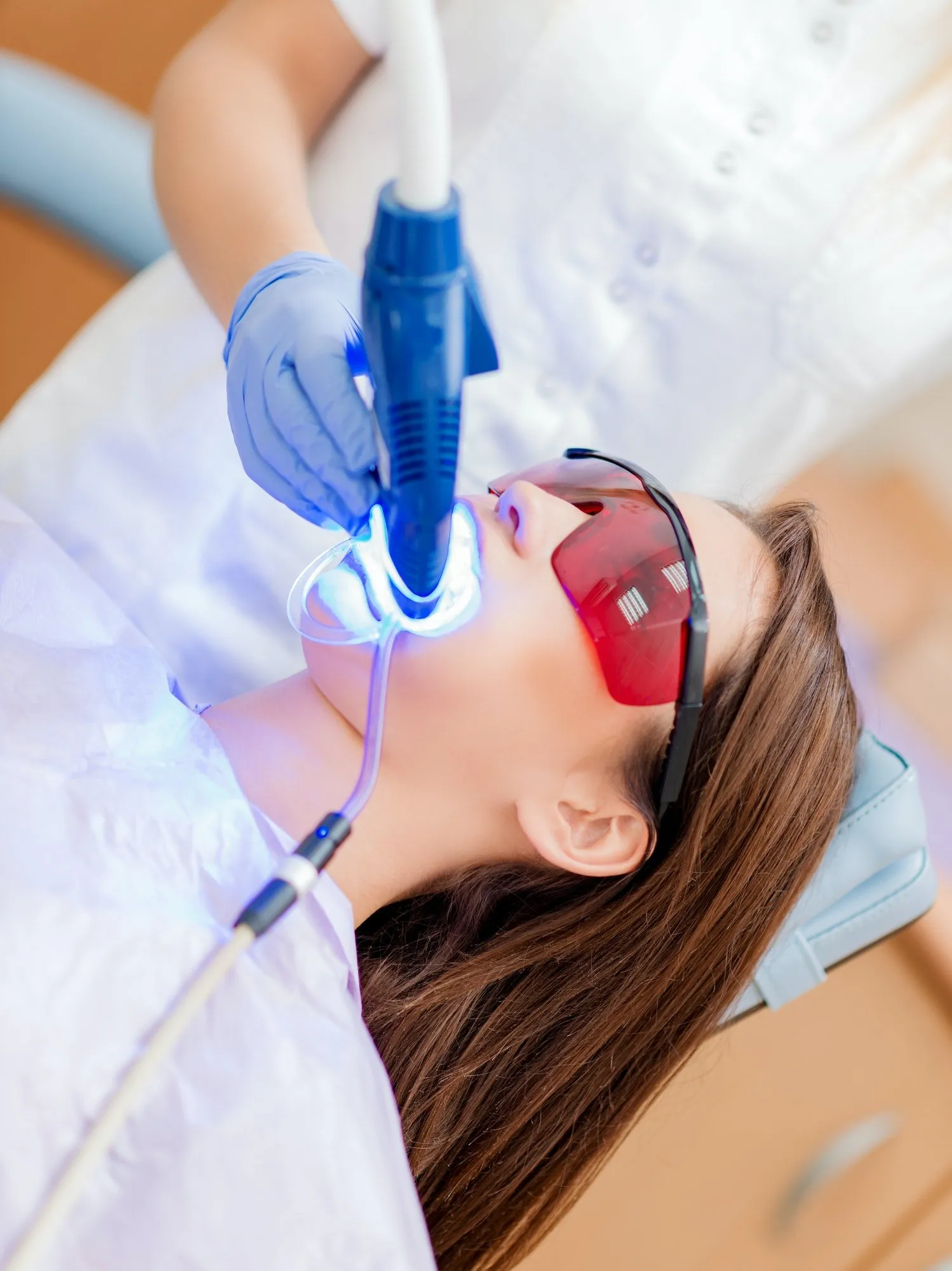 26491 teeth whitening wien image6