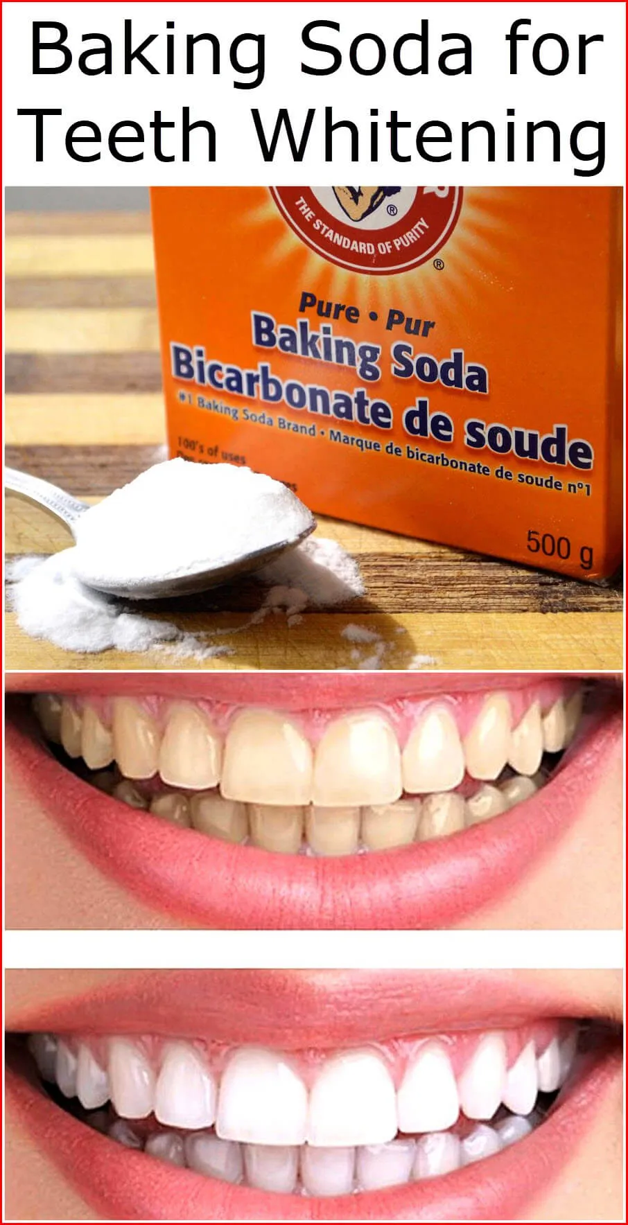 26500 teeth whitening guide