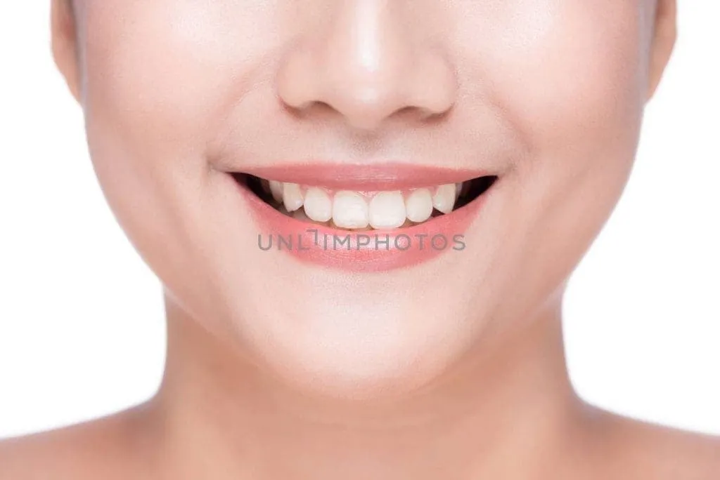 26500 teeth whitening results