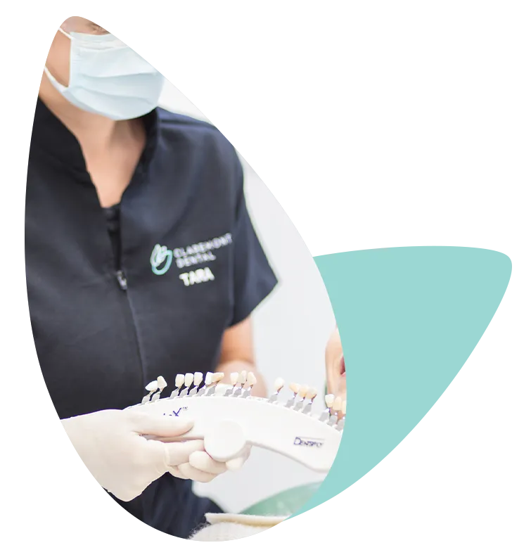 26508 teeth whitening at home kit