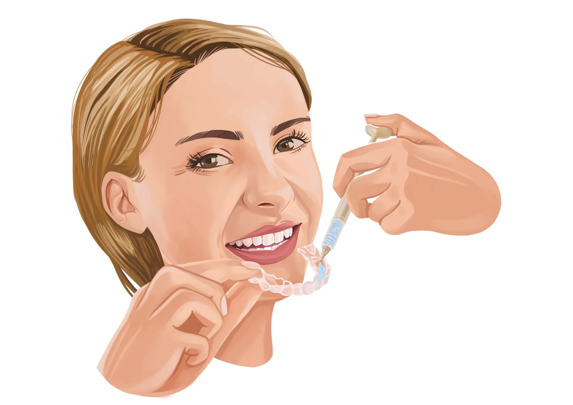 /img/26512-teeth-whitening-results.webp