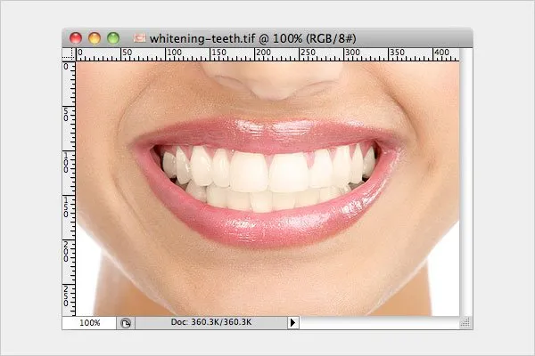 26512 whitening methods
