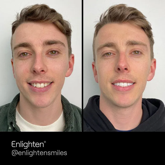 26529 foods that stain teeth