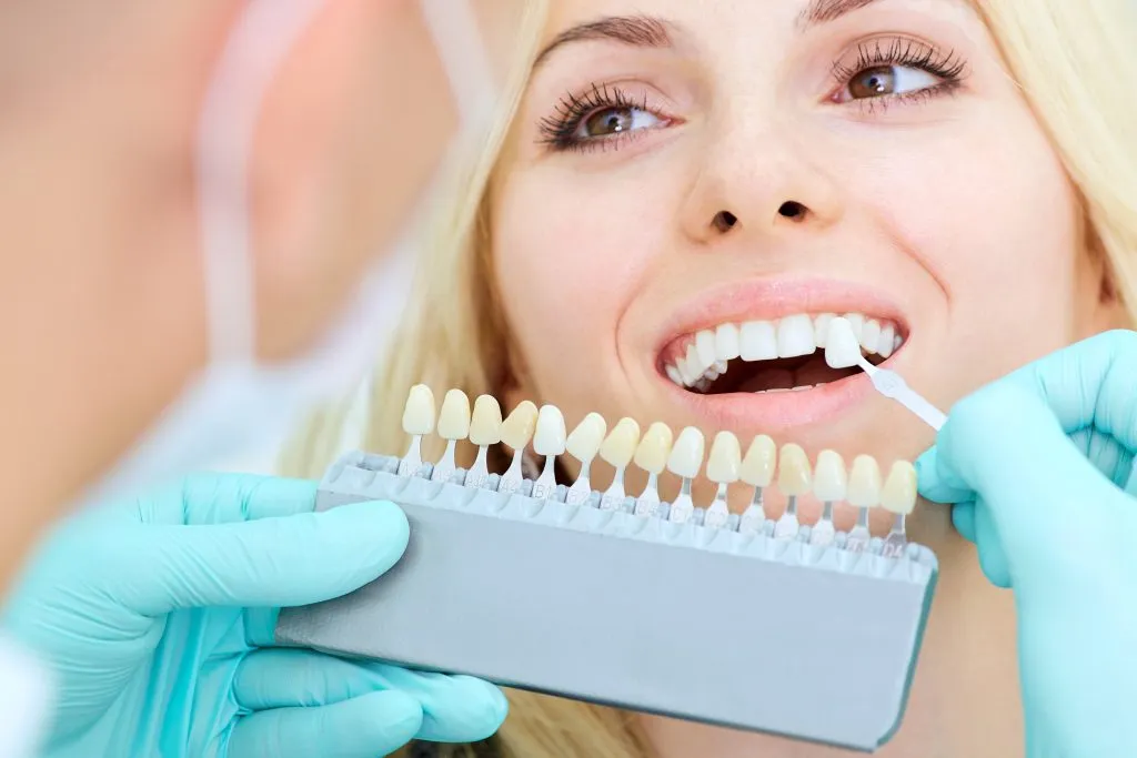 /img/26530-teeth-whitening-maintenance.webp
