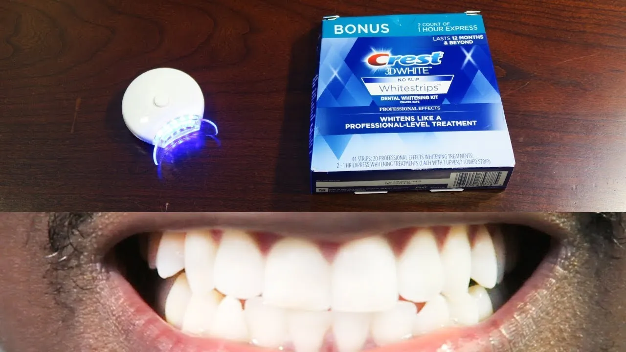 /img/26542-teeth-whitening-kit-components.webp