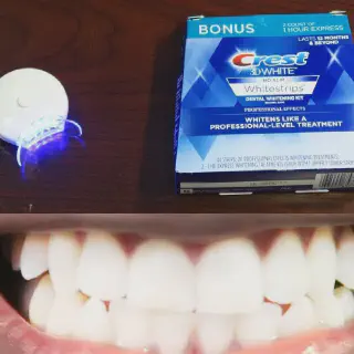 /img/26542-teeth-whitening-kit-components.webp
