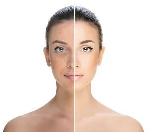 26551 dermatologist consultation