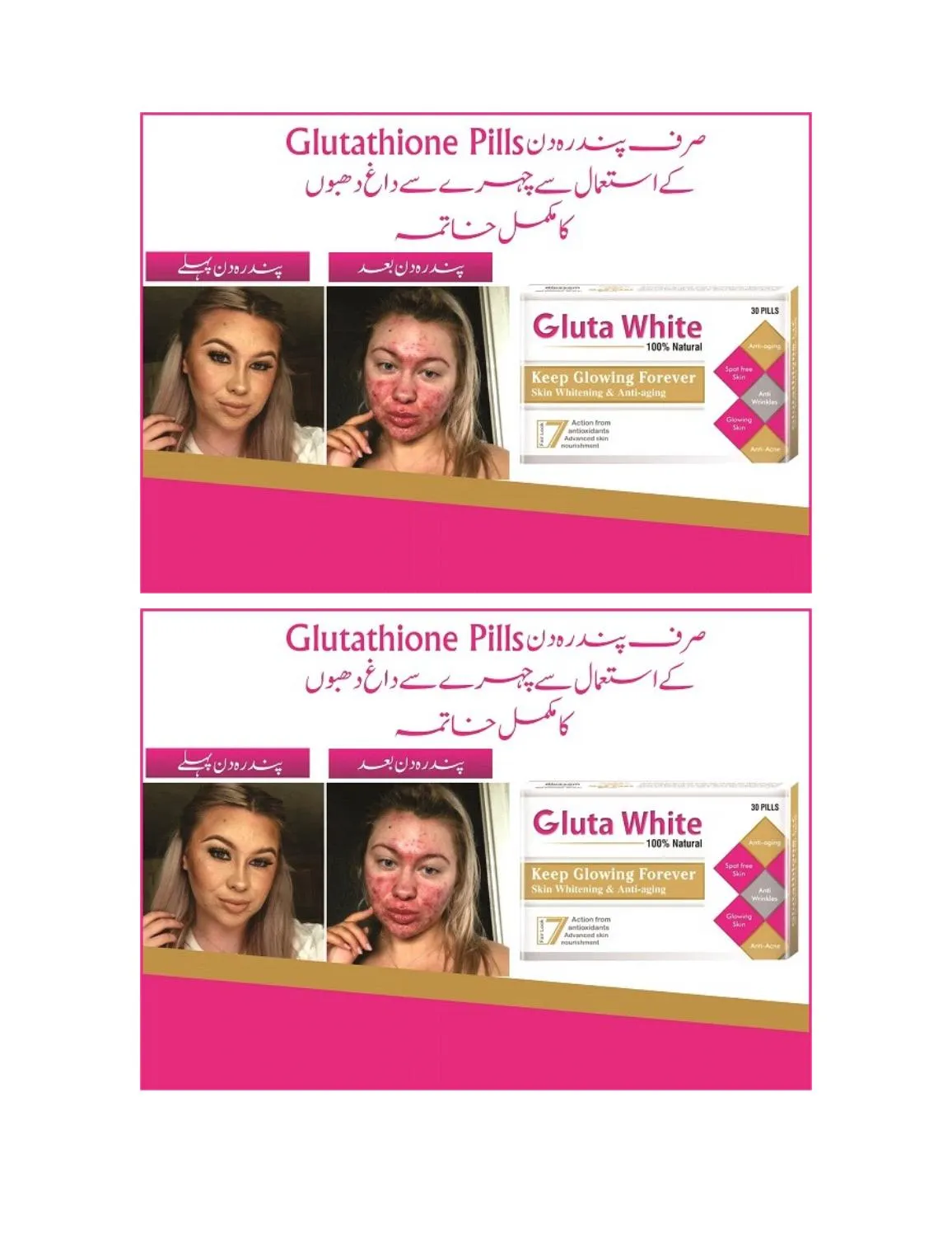 26556 whitening injection pakistan 1