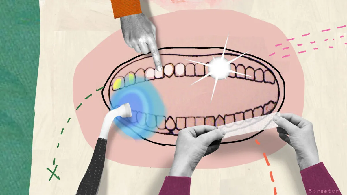 26566 marketing teeth whitening