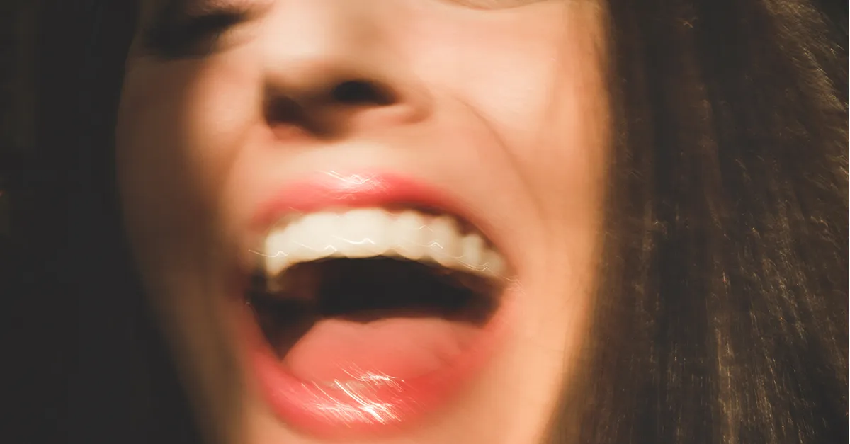 26569 professional teeth whitening