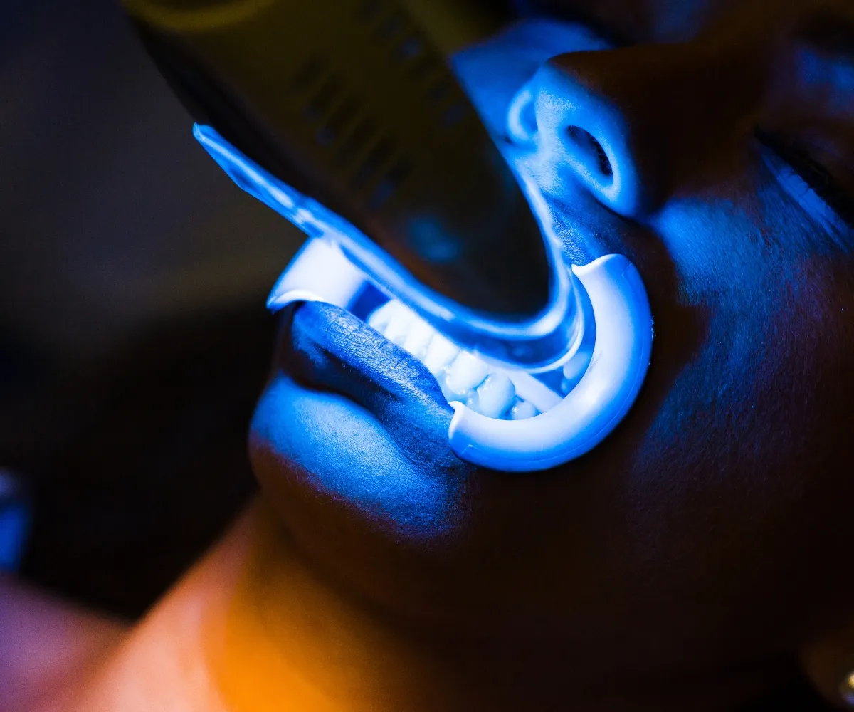 26589 maintaining teeth whiteness