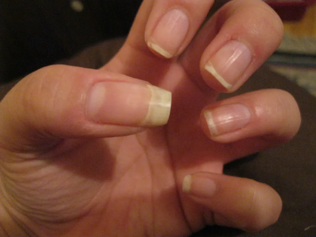 26595 whitening toothpaste nails