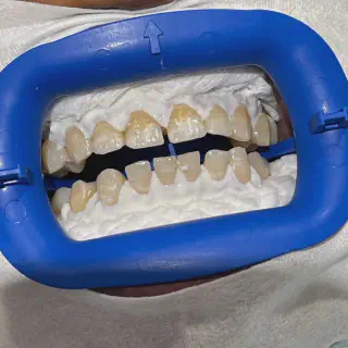 /img/26597-teeth-whitening-training-georgia-image8.webp