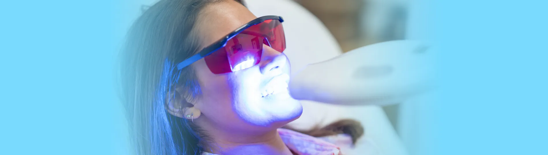 26598 iveri whitening consultation