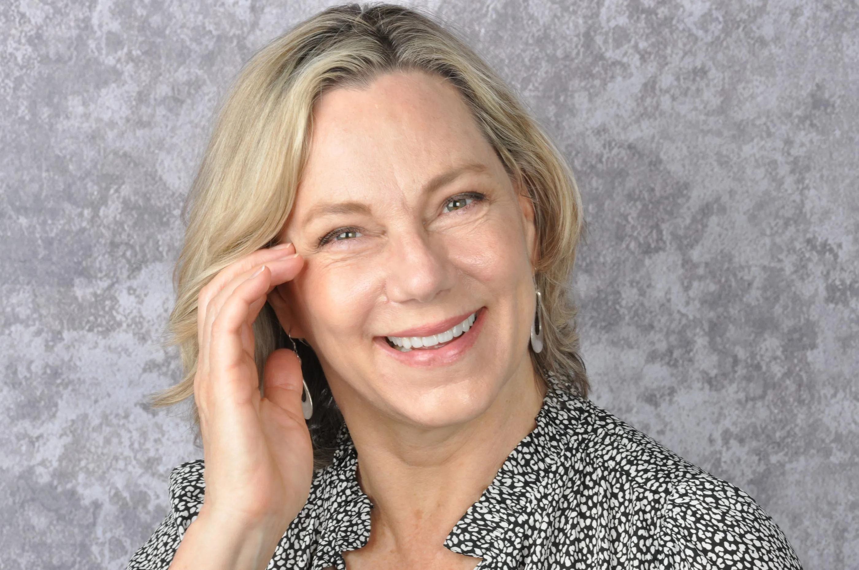 26603 teeth whitening procedure