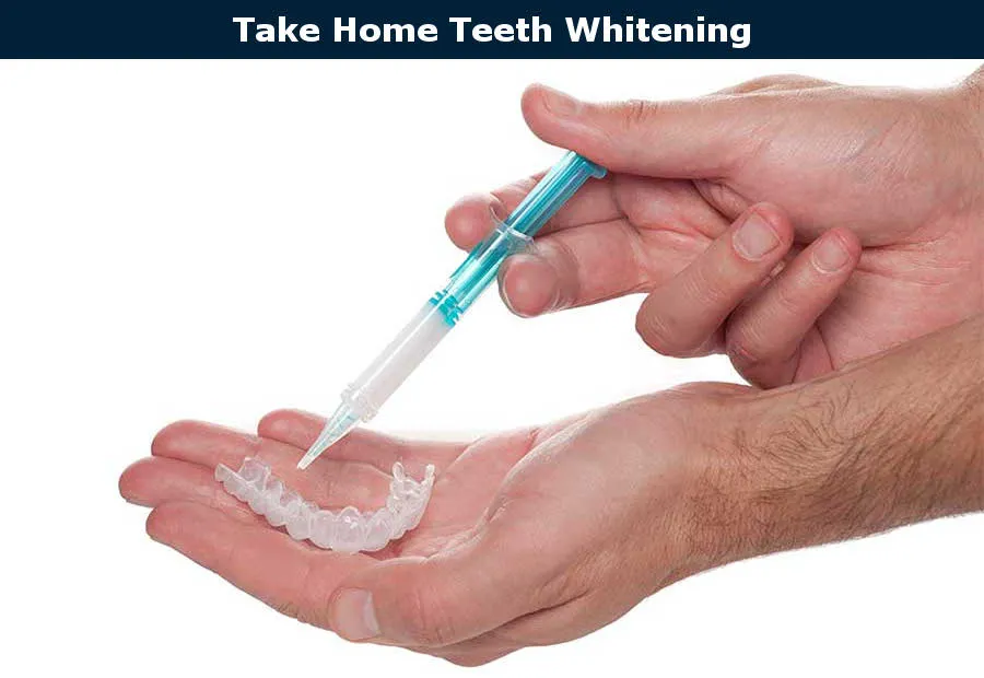 26606 teeth whitening burbank 3