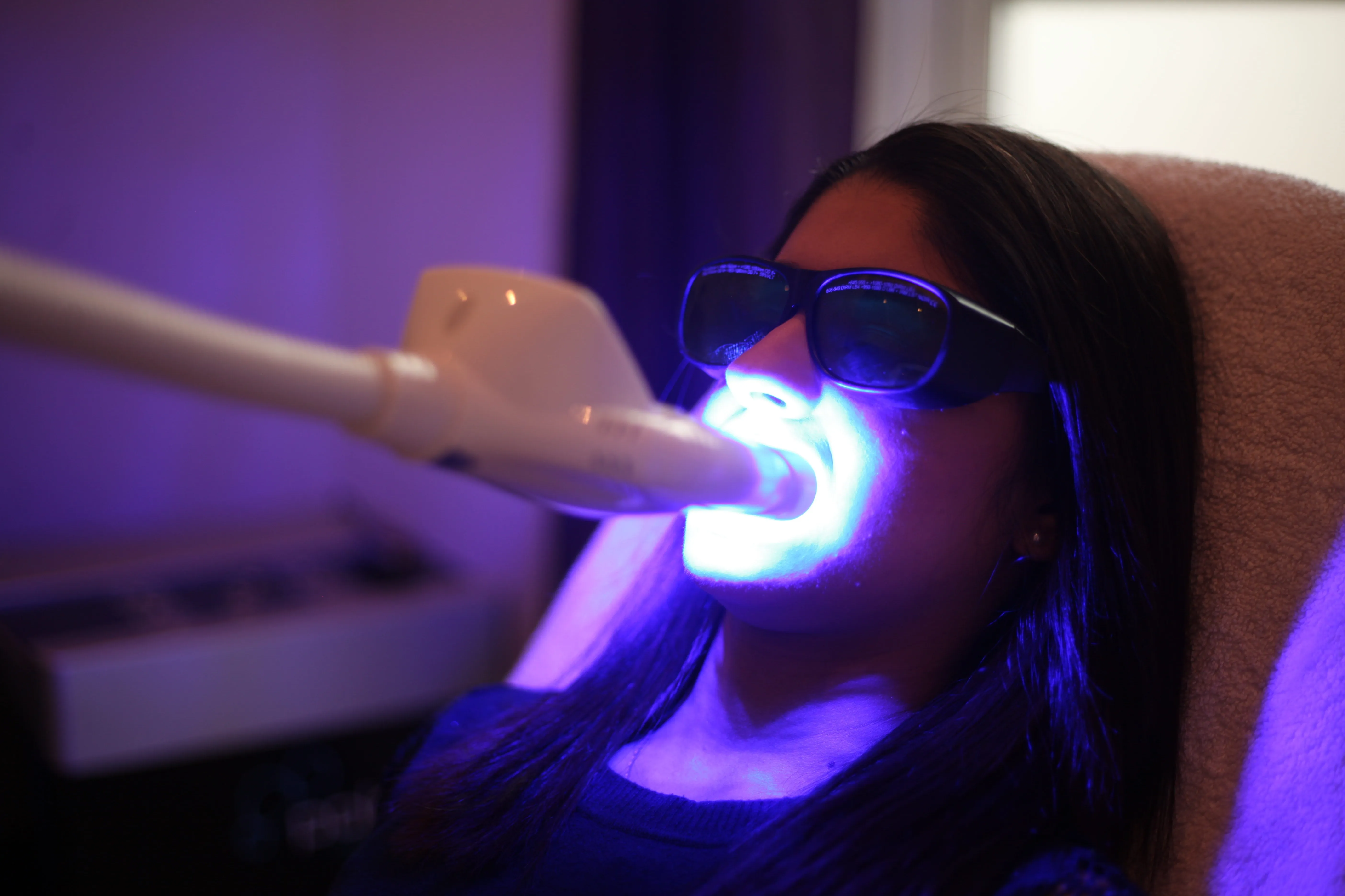 26606 teeth whitening burbank 5