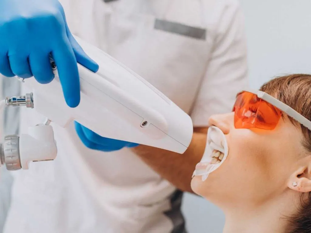 26612 teeth whitening procedure