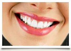 26613 in office teeth whitening