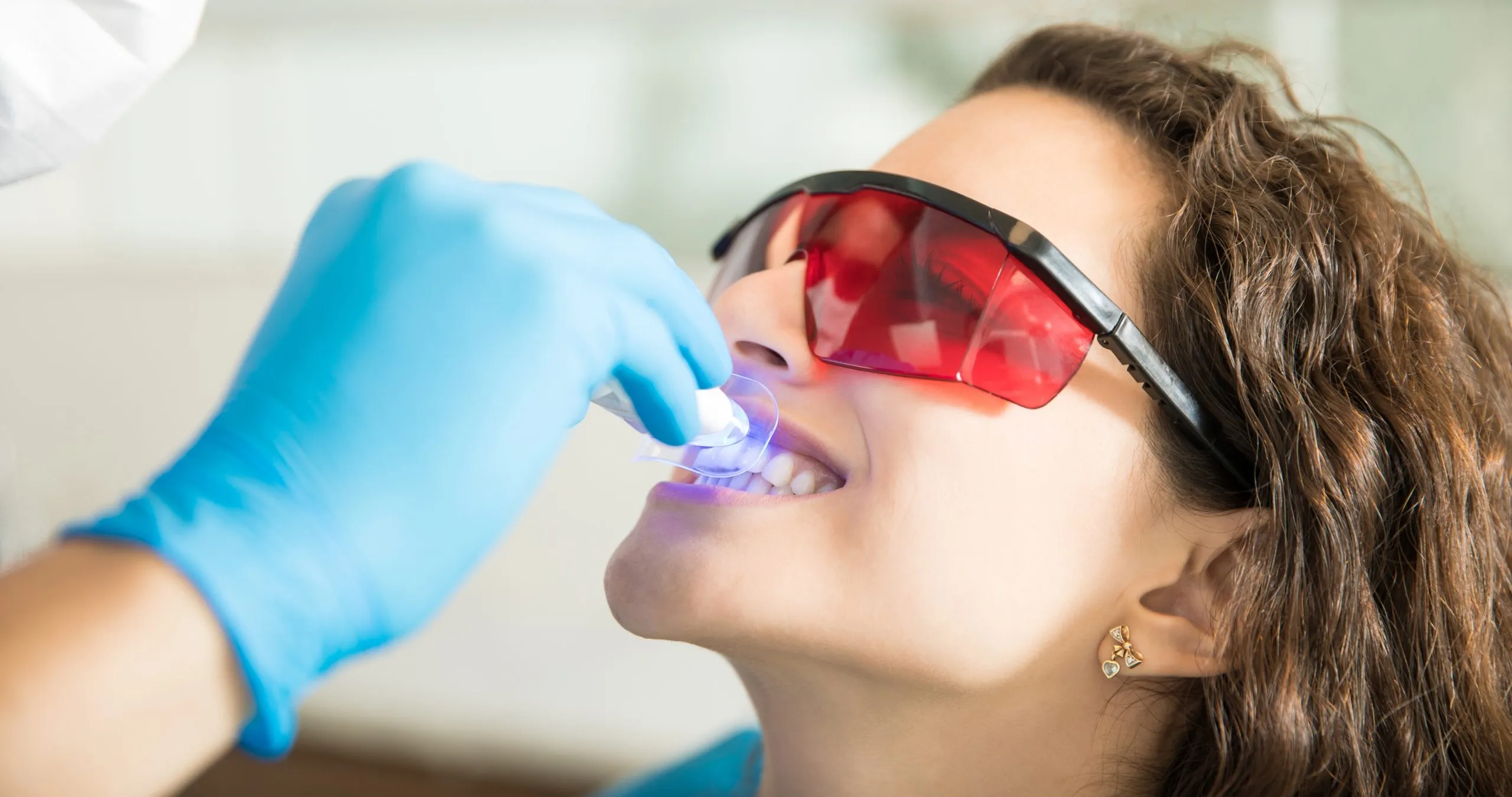 26618 teeth whitening clinic spain