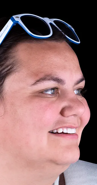 26618 teeth whitening cost spain