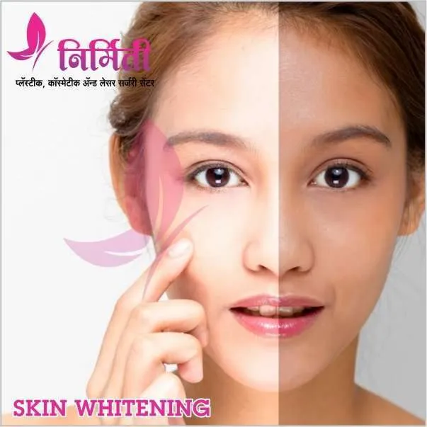 26625 laser skin whitening pune