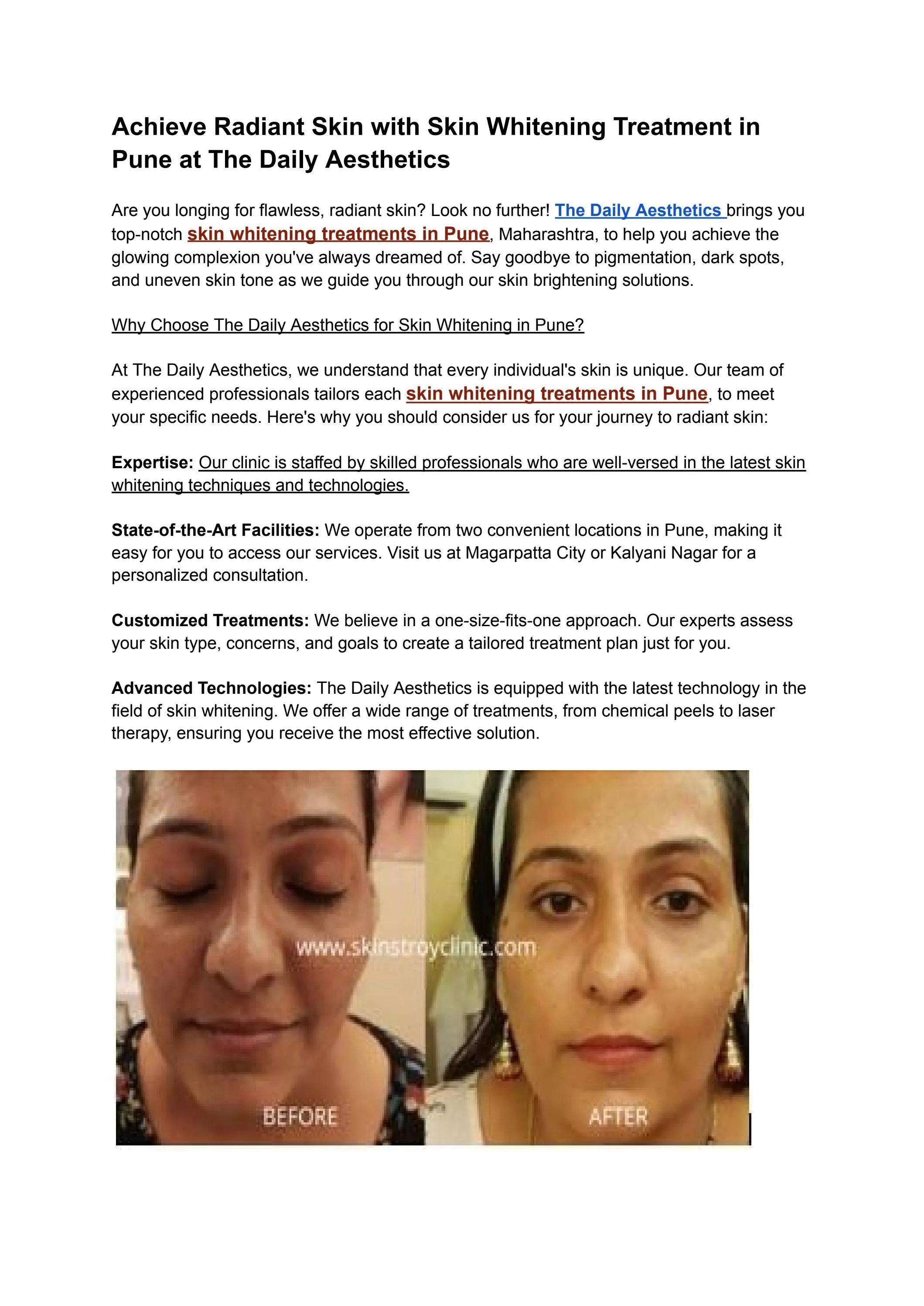 26625 microdermabrasion skin whitening