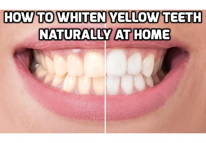 26628 turmeric teeth