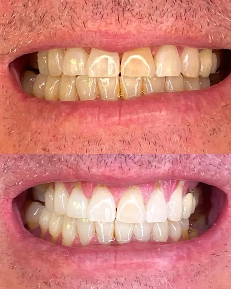 26639 esthetician consultation