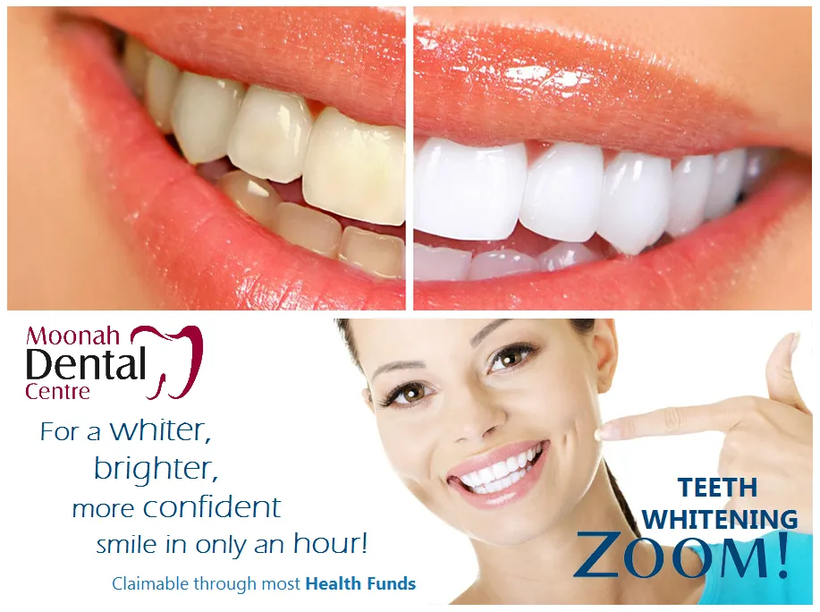 26647 tooth discoloration causes