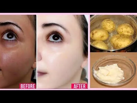 /img/26662-potato-skin-whitening-image7.webp