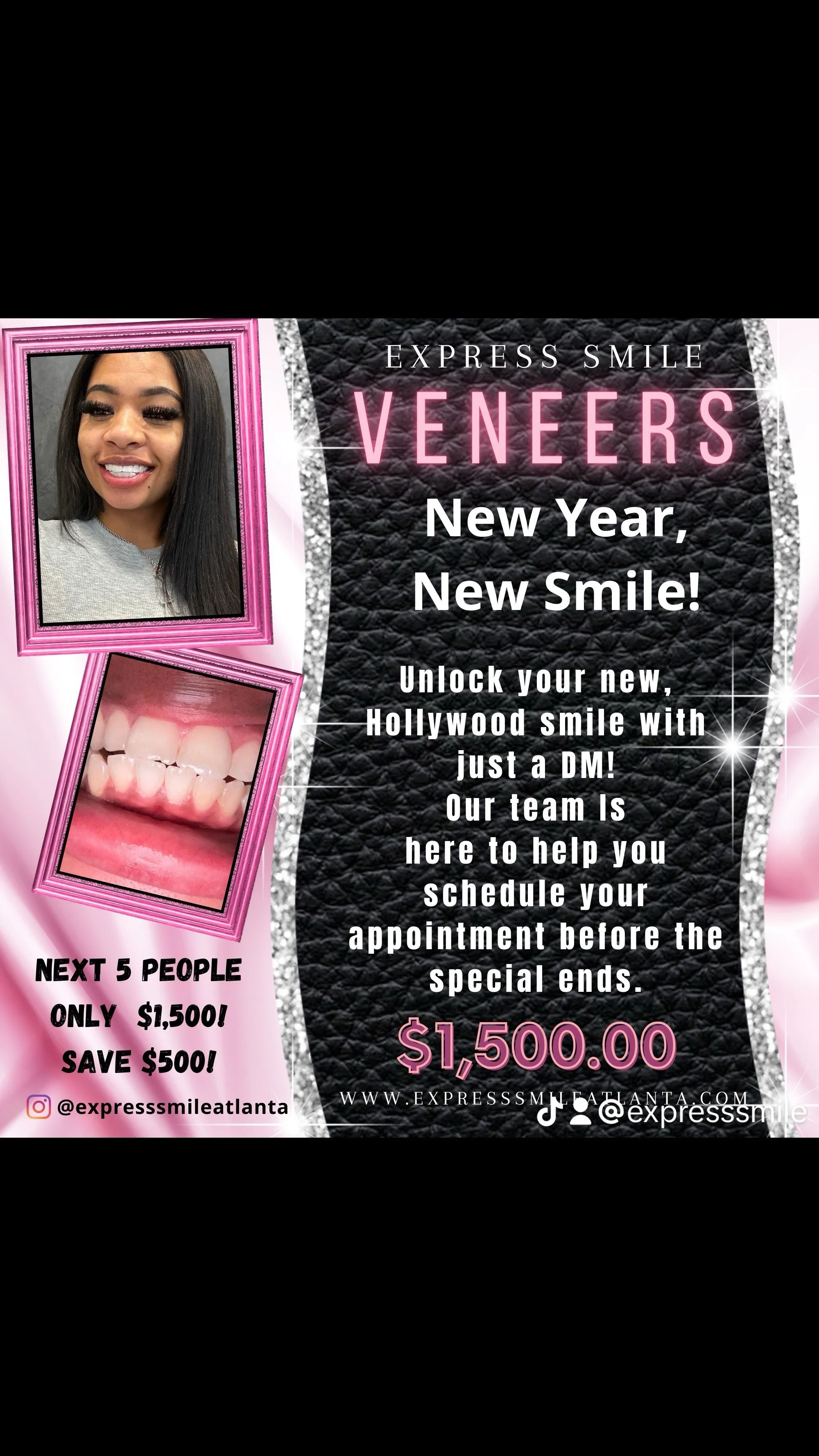 26663 at home teeth whitening kit