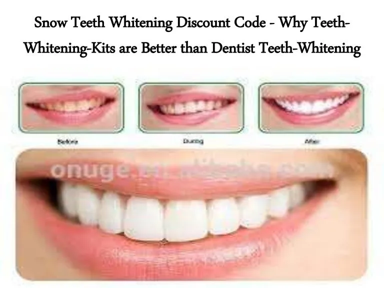 26667 snow teeth whitening social media