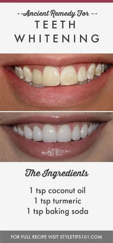 26668 whitening strips sore teeth 4