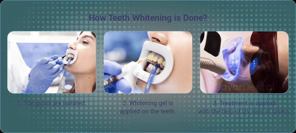 26672 dentist consultation