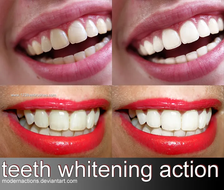 26675 edited teeth image