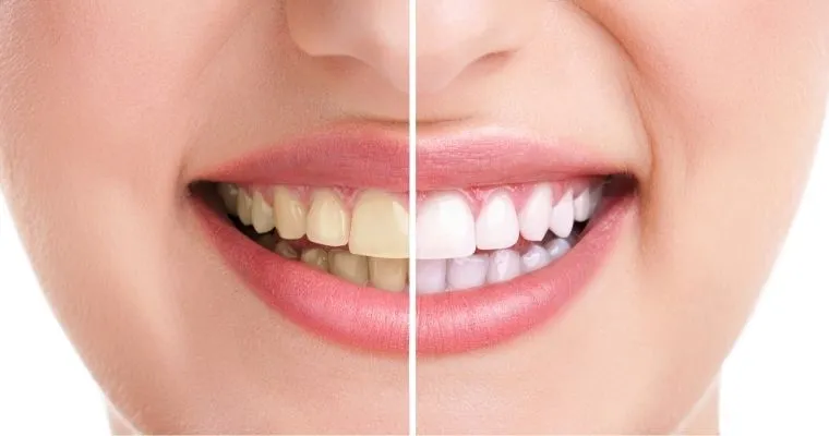 26676 whitening toothpaste
