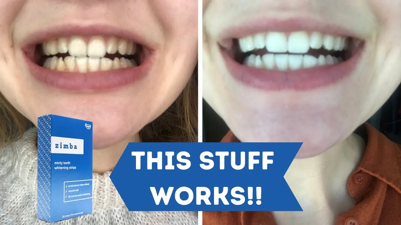 26687 teeth whitening process