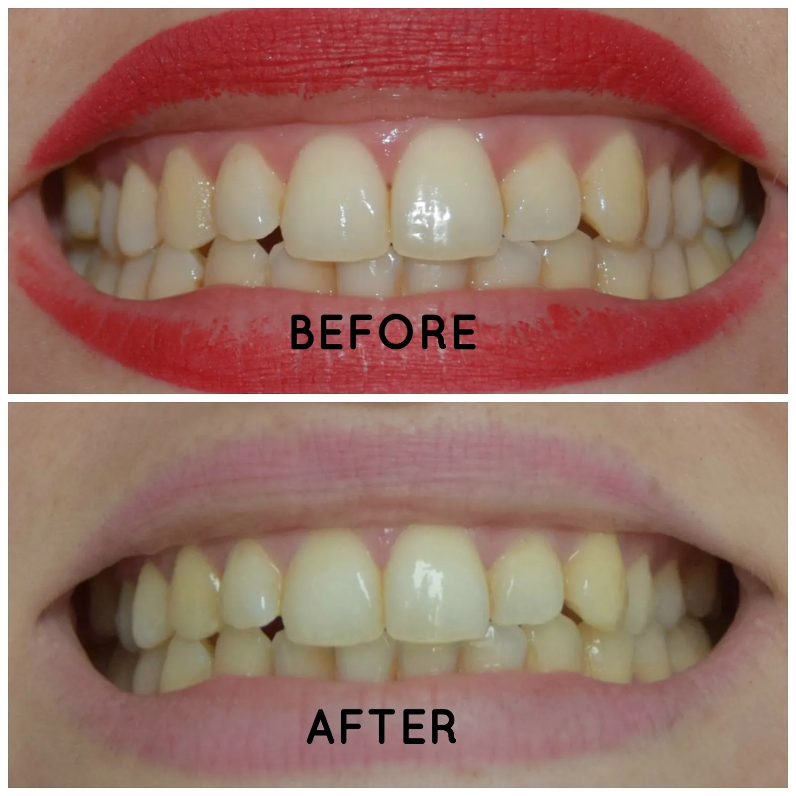 26693 white glo kit and packaging