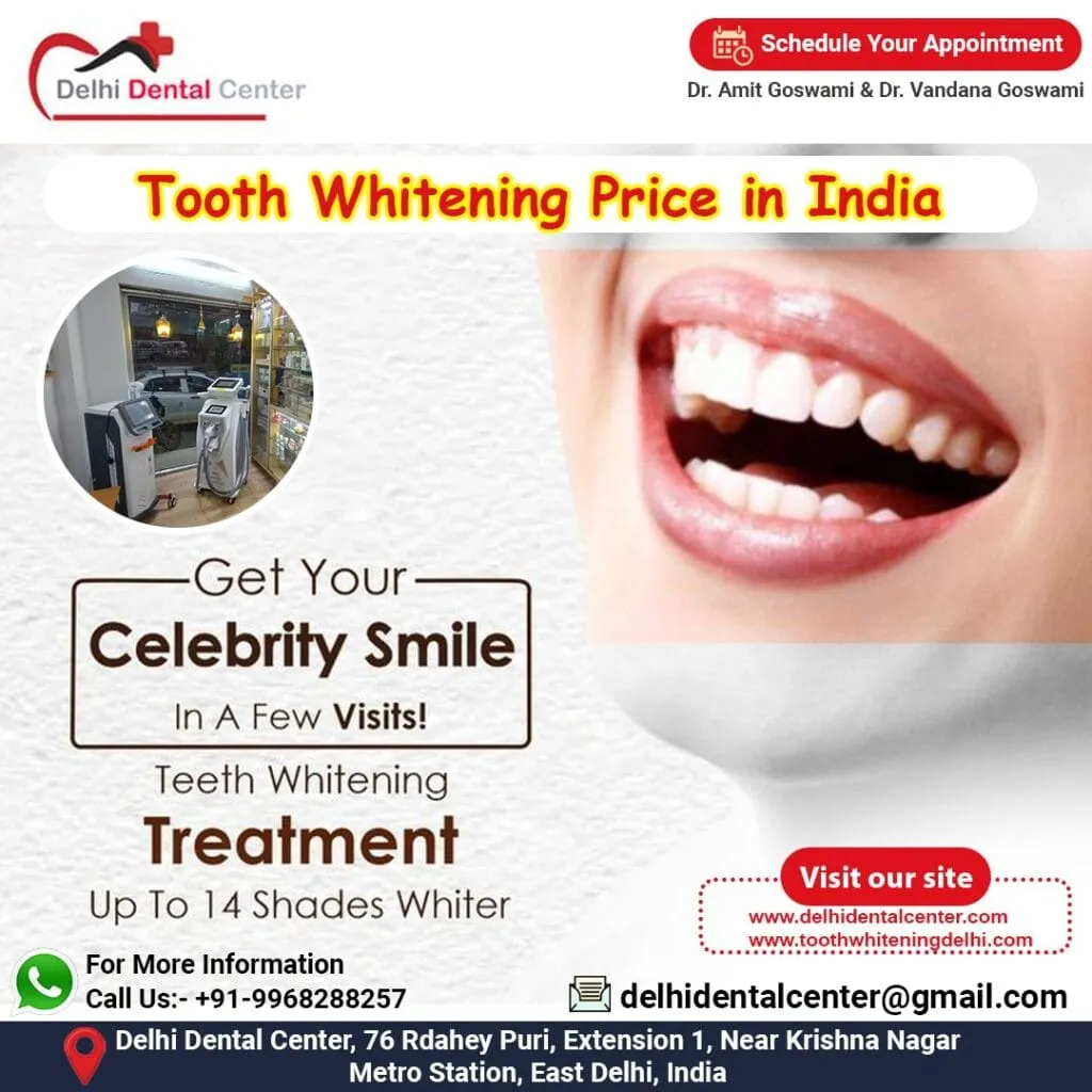 26696 teeth whitening at home