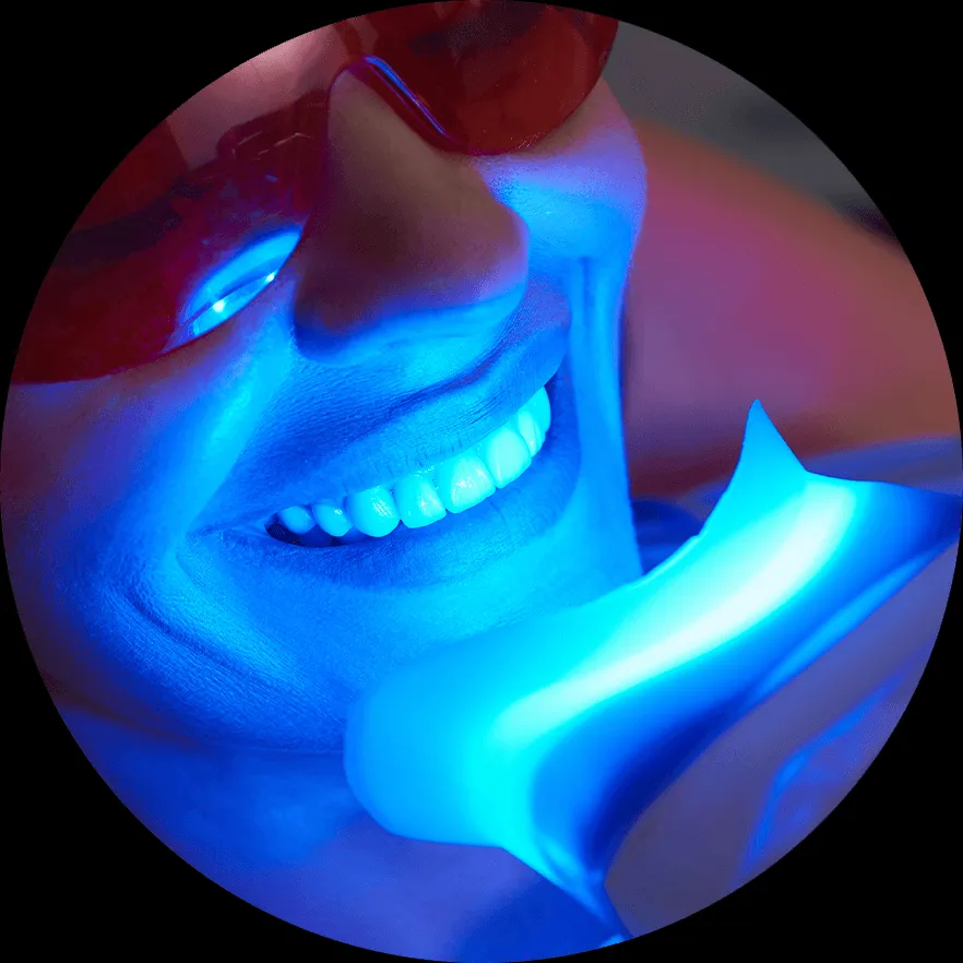 /img/26697-teeth-whitening-smile.webp