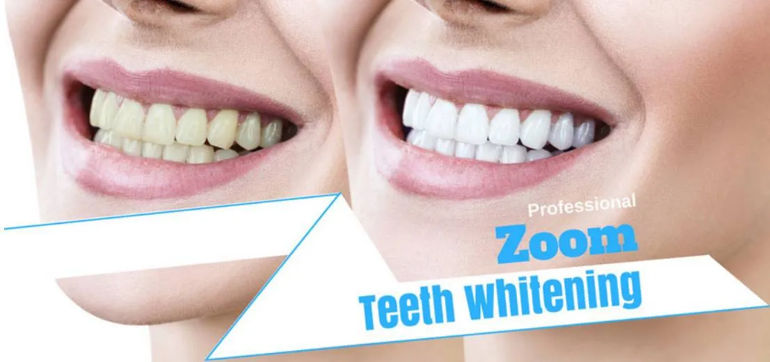 26697 zoom teeth whitening phuket clinic