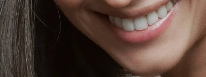 26705 at home whitening