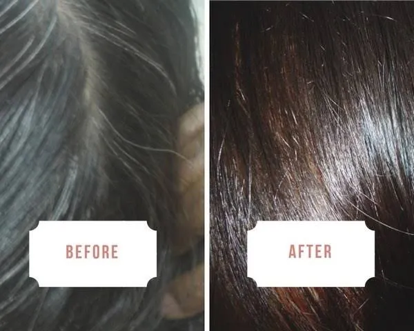 26706 genetic influence on hair