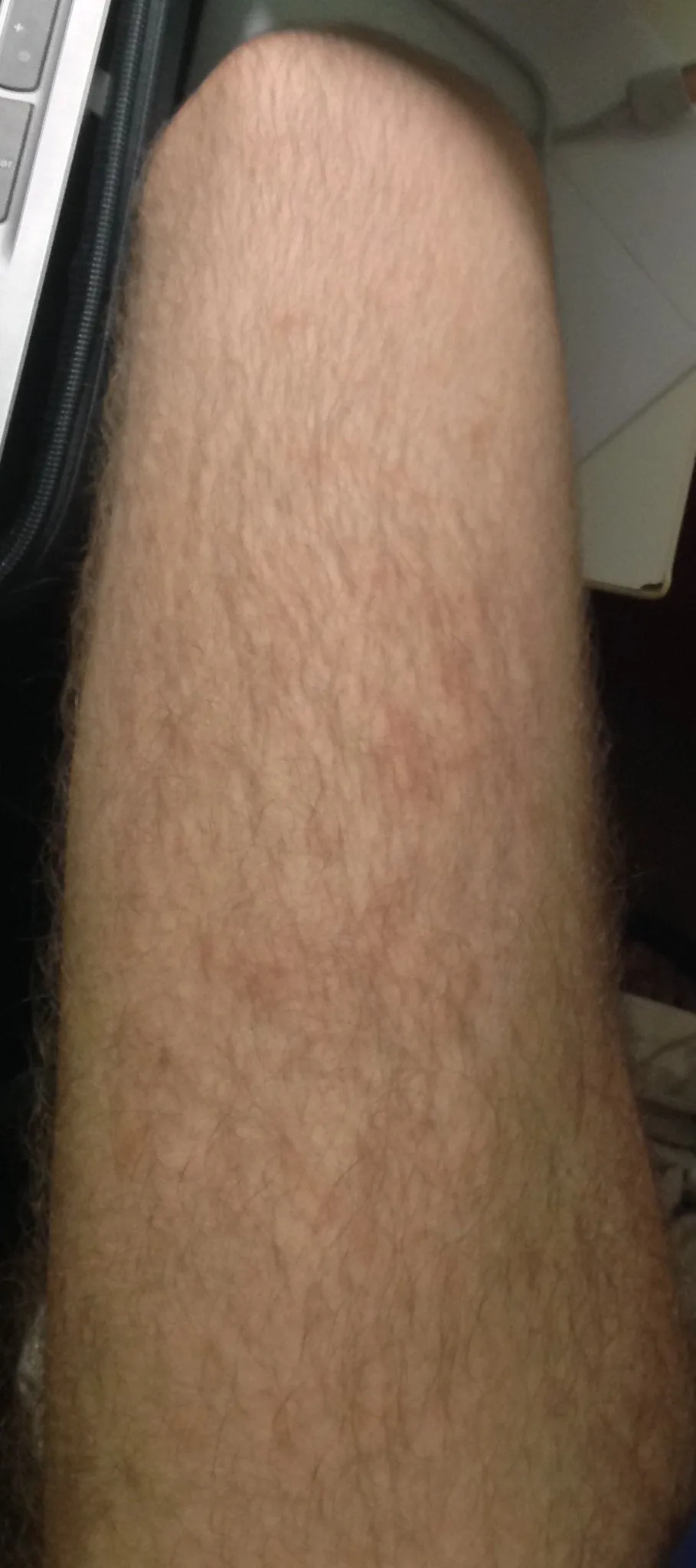 26722 whitening strip pain sensitivity toothpaste