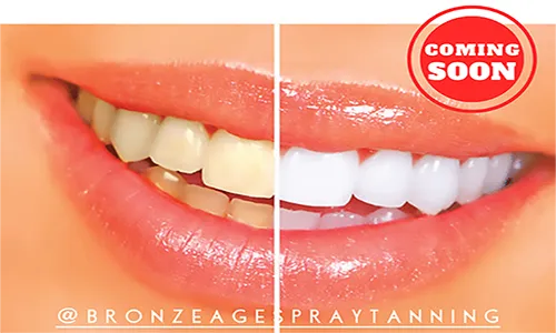 26727 teeth whitening tanning salon image1