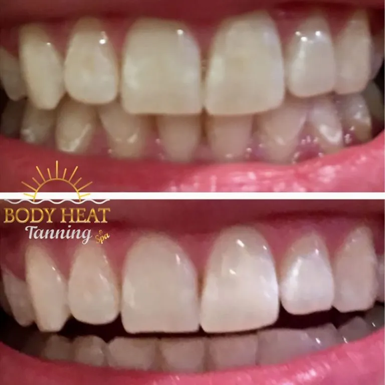 26727 teeth whitening tanning salon image3