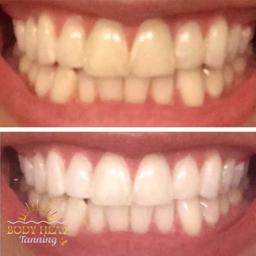 26727 teeth whitening tanning salon image5