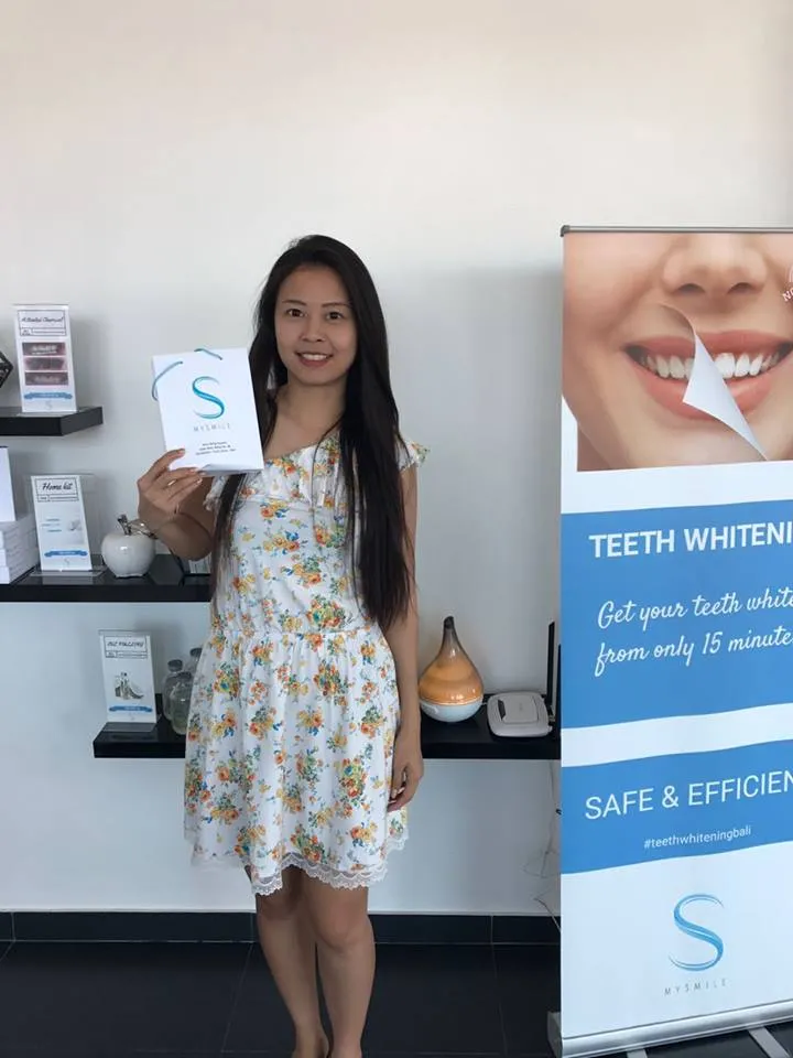 26731 mysmile whitening products